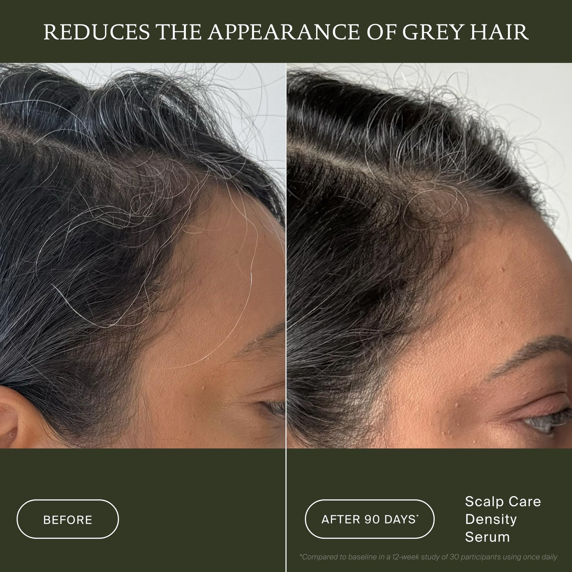 Dark Slate Gray Living Proof Scalp Care Density Serum
