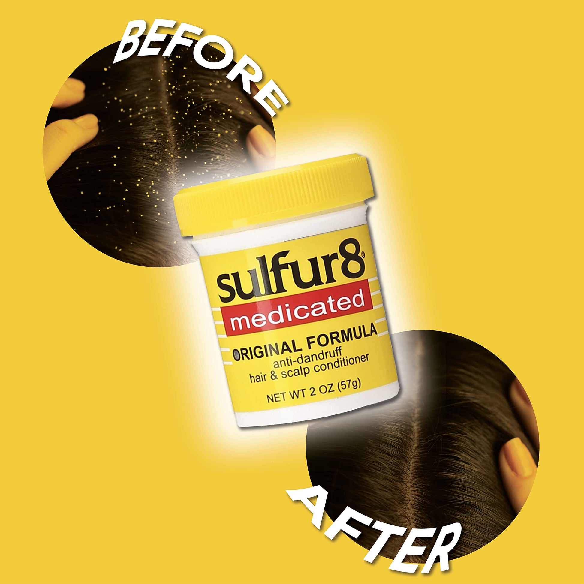 Goldenrod Sulfur 8 Medicated Anti-Dandruff Hair & Scalp Conditioner 2 oz – Helps Control Dandruff, Soothes Itchy Scalp & Moisturizes Hair with Refreshing Clean Fragrance, For All Hair Types (Pack of 2)