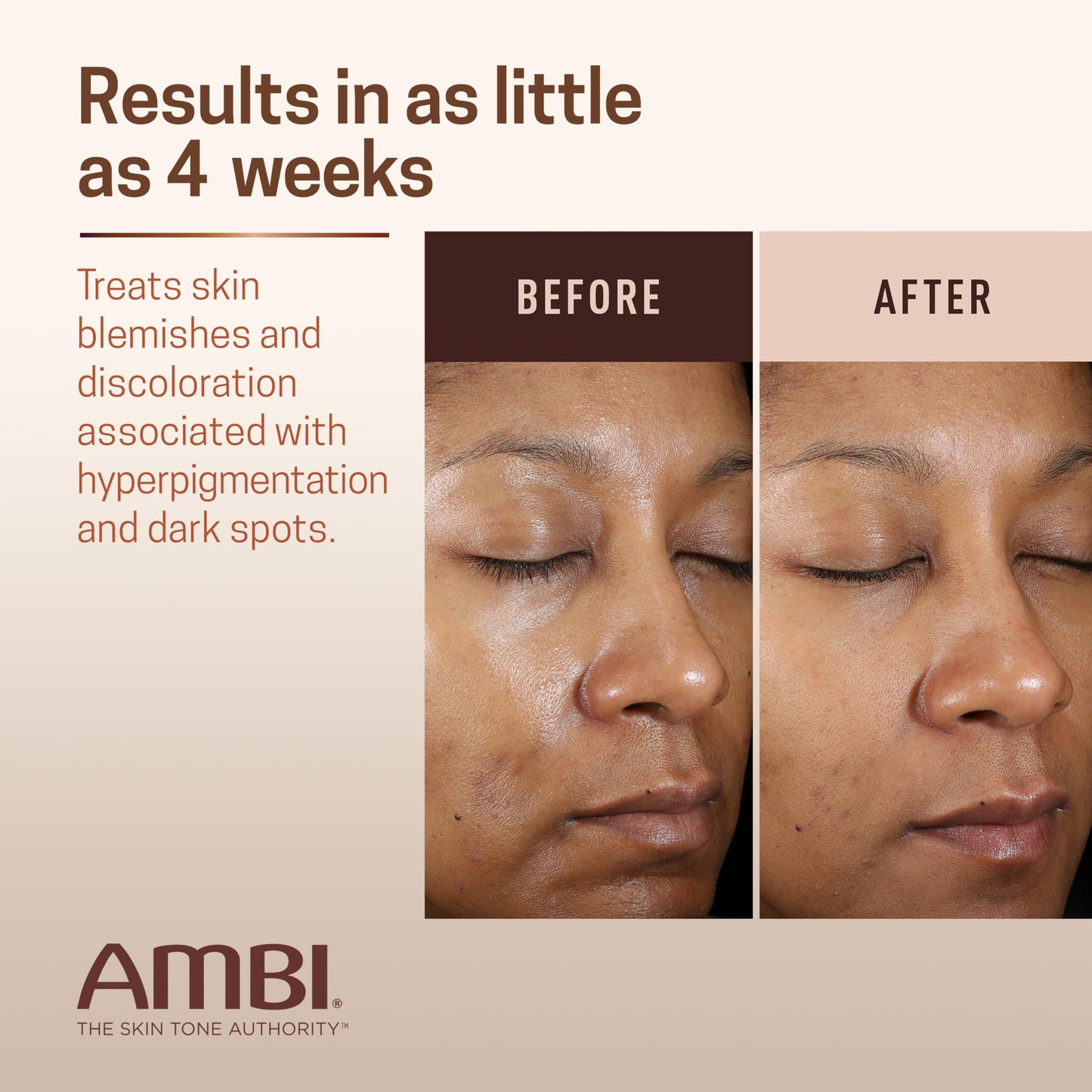 Seashell Ambi Even & Clear Advanced Fade Cream, Hydroquinone-free, Hyperpigmentation Treatment, Stubborn Dark Spot Corrector, Results In As Little As 2-3 Weeks, Niacinamide, Licorice Root Extract, PHA, 1 Fl Oz