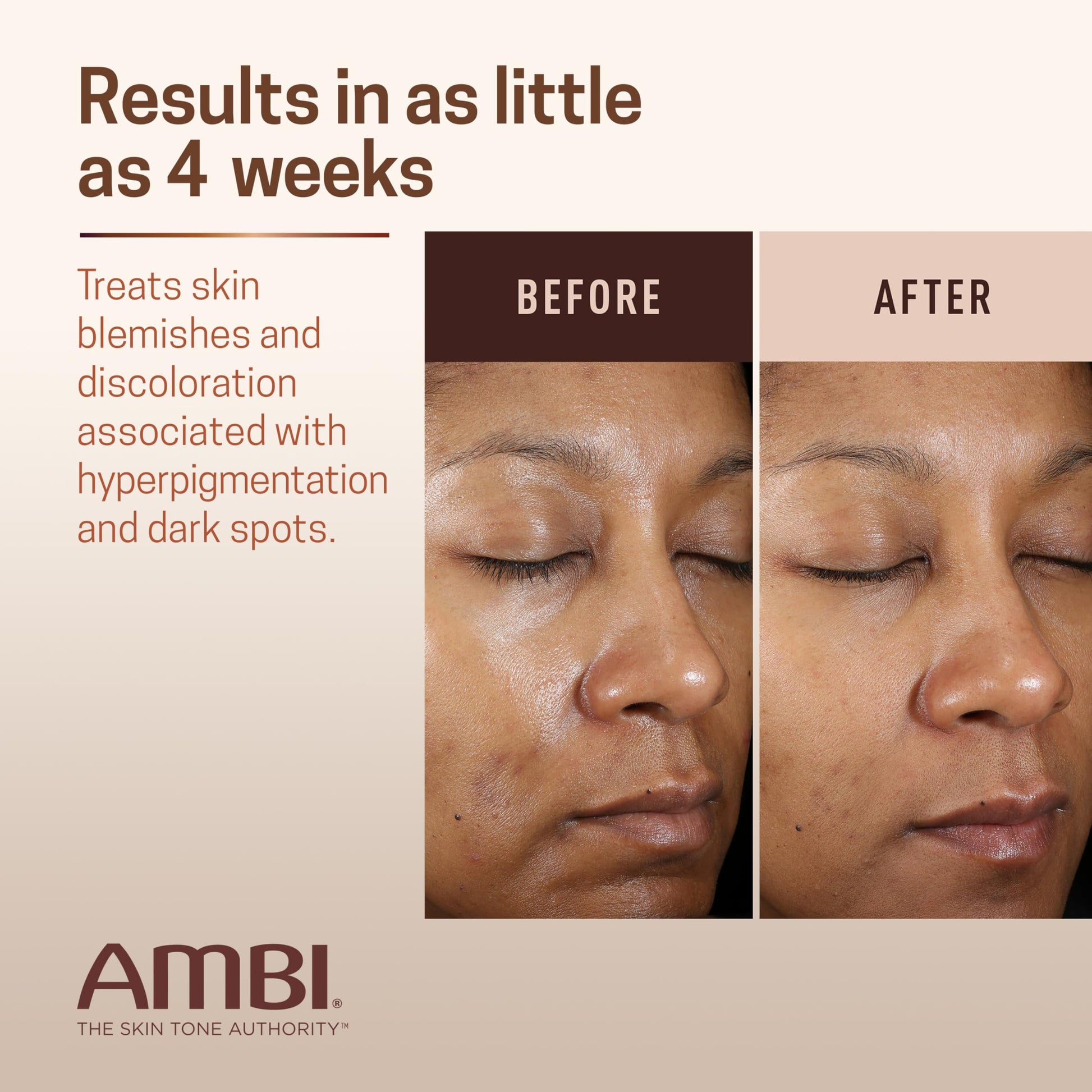 Seashell Ambi Even & Clear Advanced Fade Cream, Hydroquinone-free, Hyperpigmentation Treatment, Stubborn Dark Spot Corrector, Results In As Little As 2-3 Weeks, Niacinamide, Licorice Root Extract, PHA, 1 Fl Oz