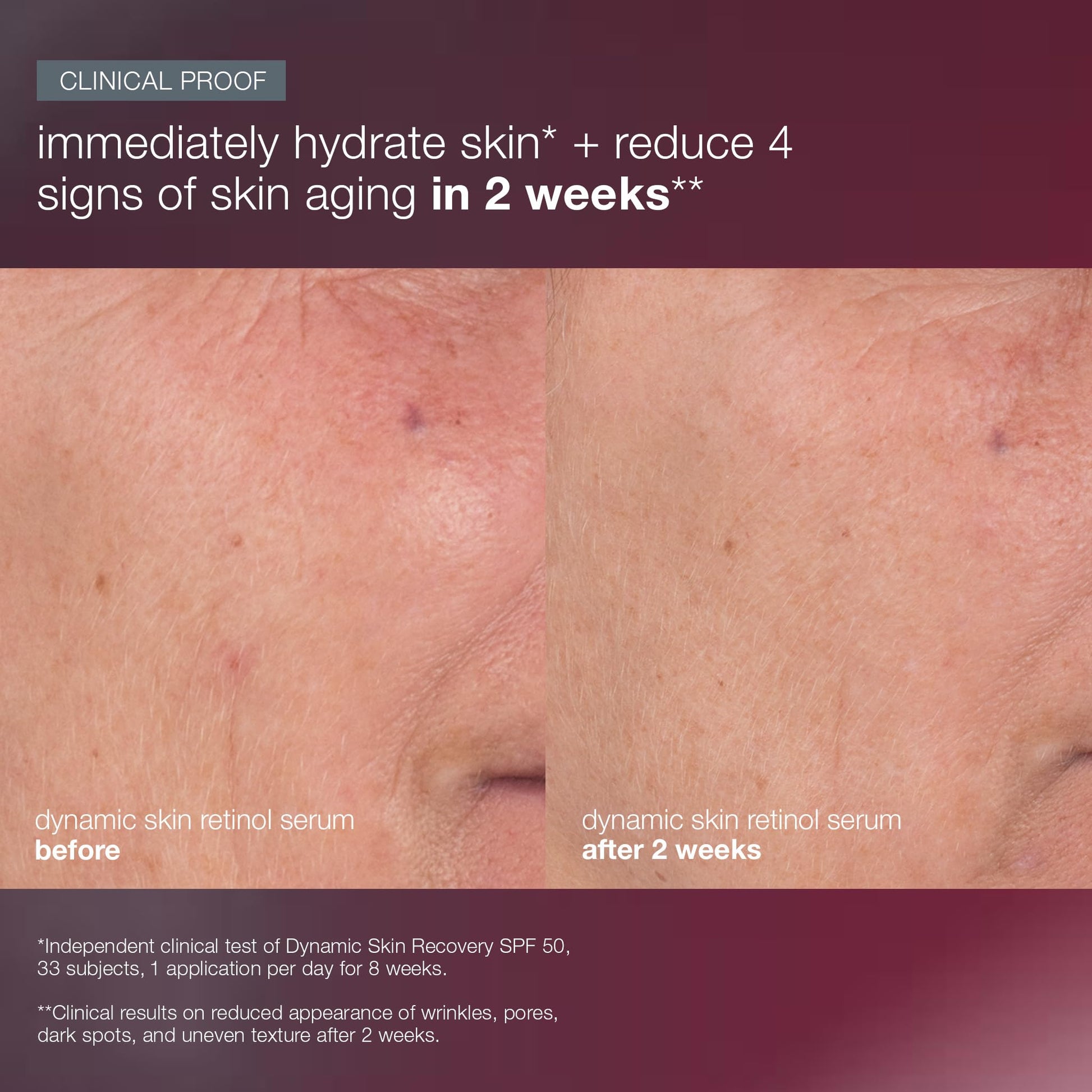 Dark Salmon Dermalogica Skin Aging Solutions Kit, Anti Aging Skincare Set - Includes: Face Cleanser, Serum, Moisturizer with SPF, and Cream, Travel Size