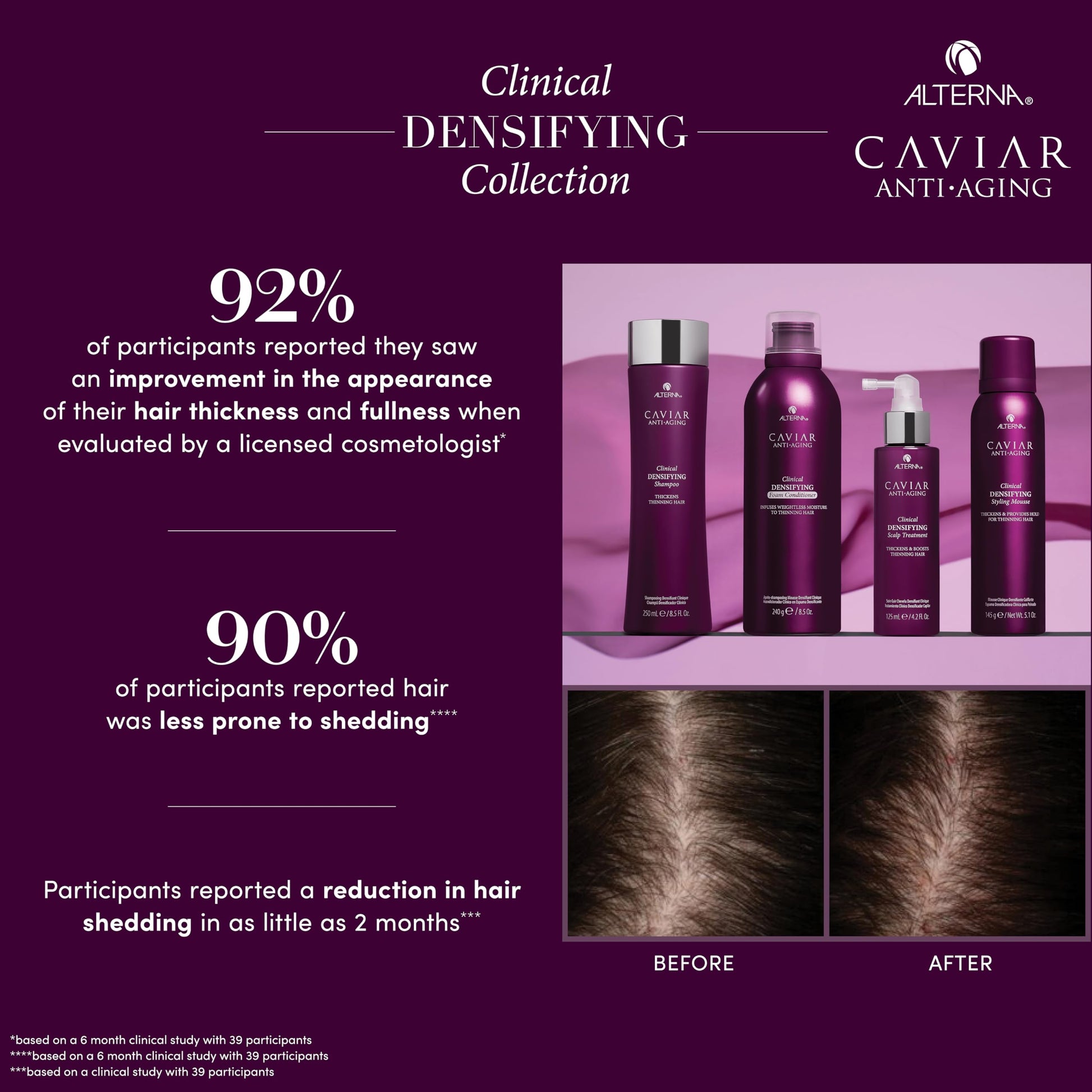 Midnight Blue Alterna Haircare CAVIAR Anti-Aging Clinical Densifying Shampoo 8.5 Fl Oz | For Fine, Thinning Hair | Thickens Hair, Protects Scalp | Sulfate Free