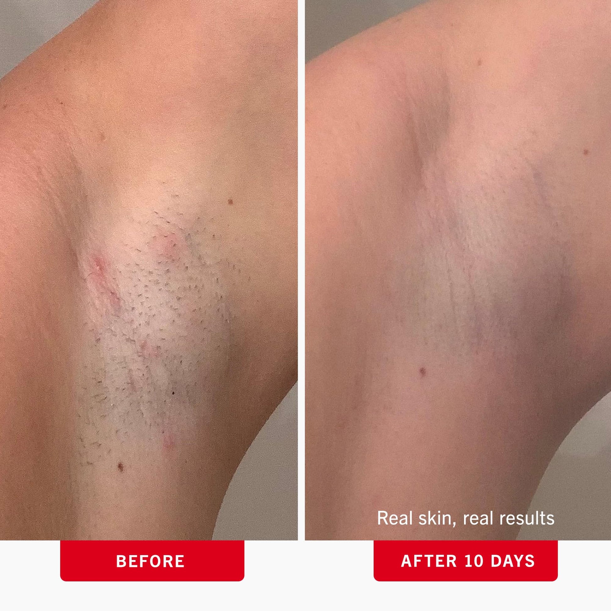 Rosy Brown First Aid Beauty - Ingrown Hair Pads with BHA + AHA - Aftershave Treatment Pads to Help Prevent Razor Bumps for Men & Women - Exfoliate Underarms & Bikini Area - Compostable for Daily Use - 28 Pads