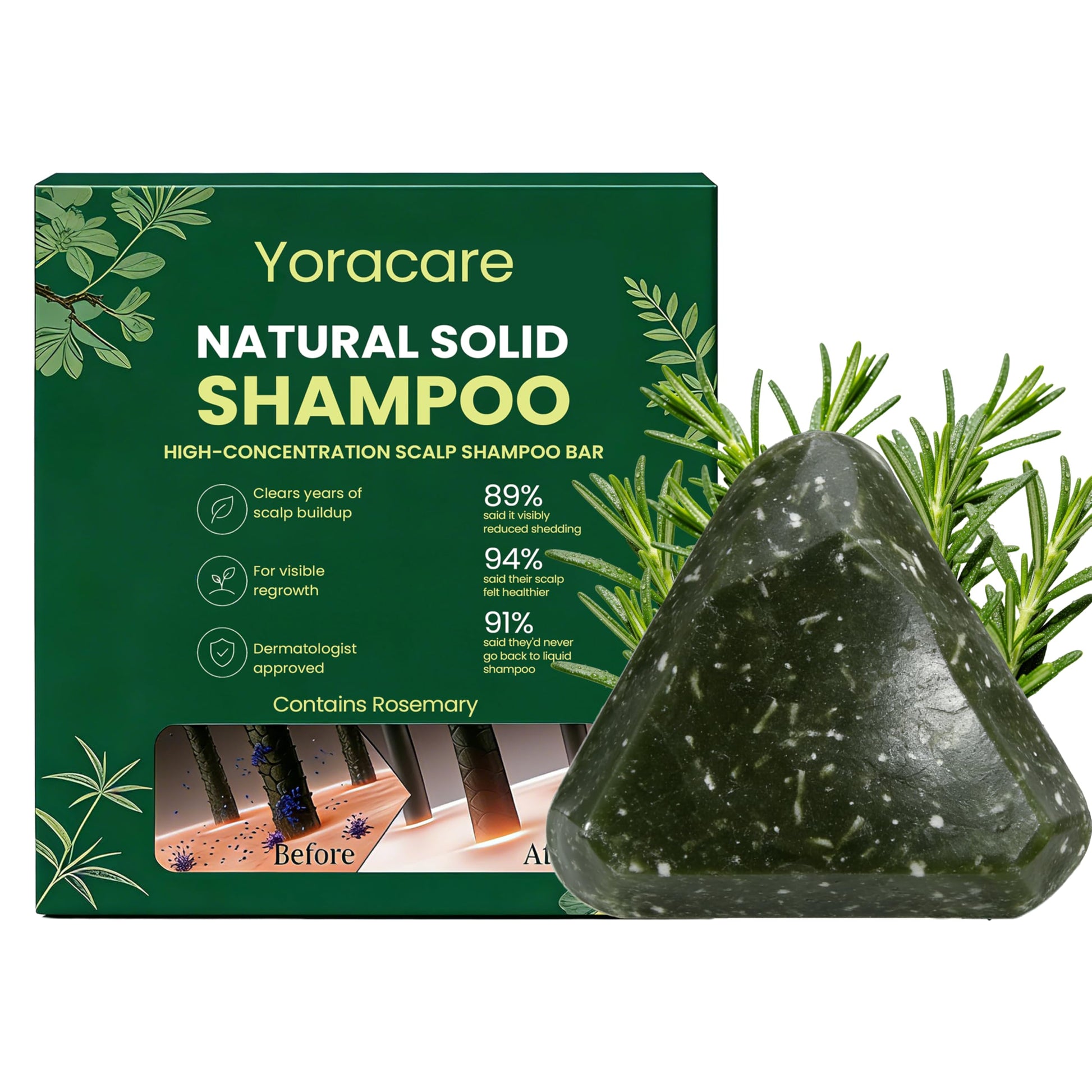 Dark Green GAGK Yoracare Rosemary & Amino Acids Strengthening Anti-Thinning Shampoo Bar, Natural Botanical Anti-Hair Loss Shampoo Bar – Gentle, Hydrating & Scalp-Friendly Herbal Care 3.71 oz
