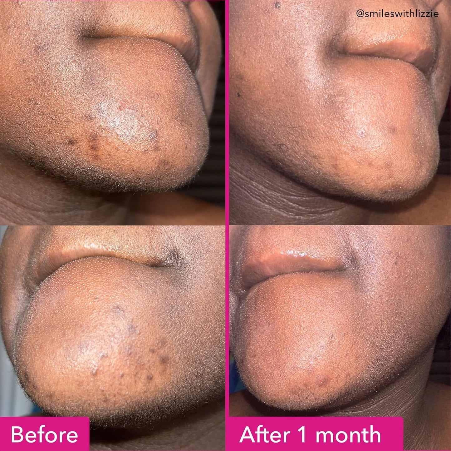 Rosy Brown Good Molecules Brightening & Dark Spots Bar - Soap Free Face and Body Bar - Tranexamic, Kojic Acids and Niacinamide to Target Dark Spots - Skin Care