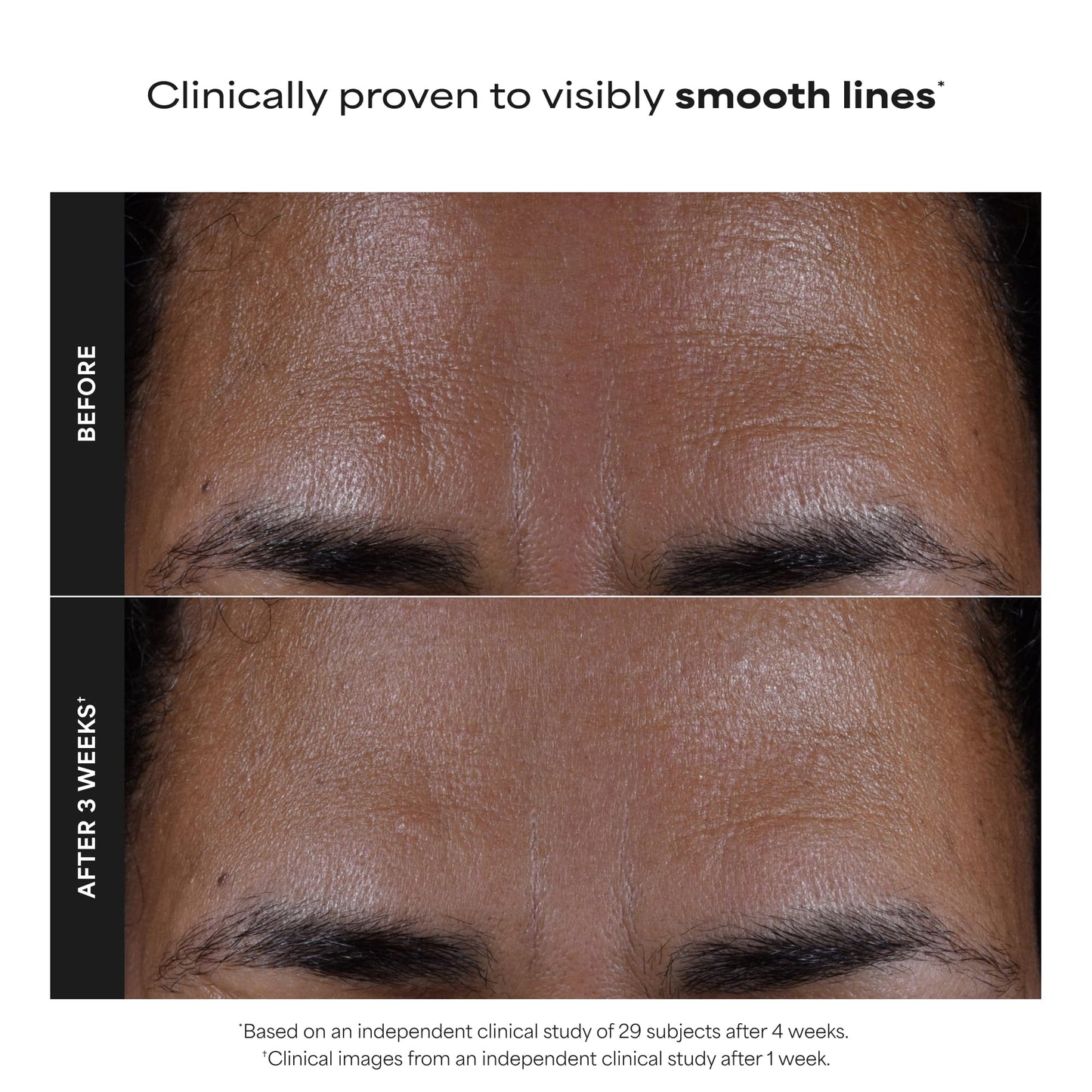 Dim Gray Paula's Choice Skin Perfecting 2% BHA Liquid Salicylic Acid Exfoliant, Gentle Facial Exfoliator for Blackheads, Large Pores, Wrinkles & Fine Lines, Travel Size, 1 Fluid Ounce