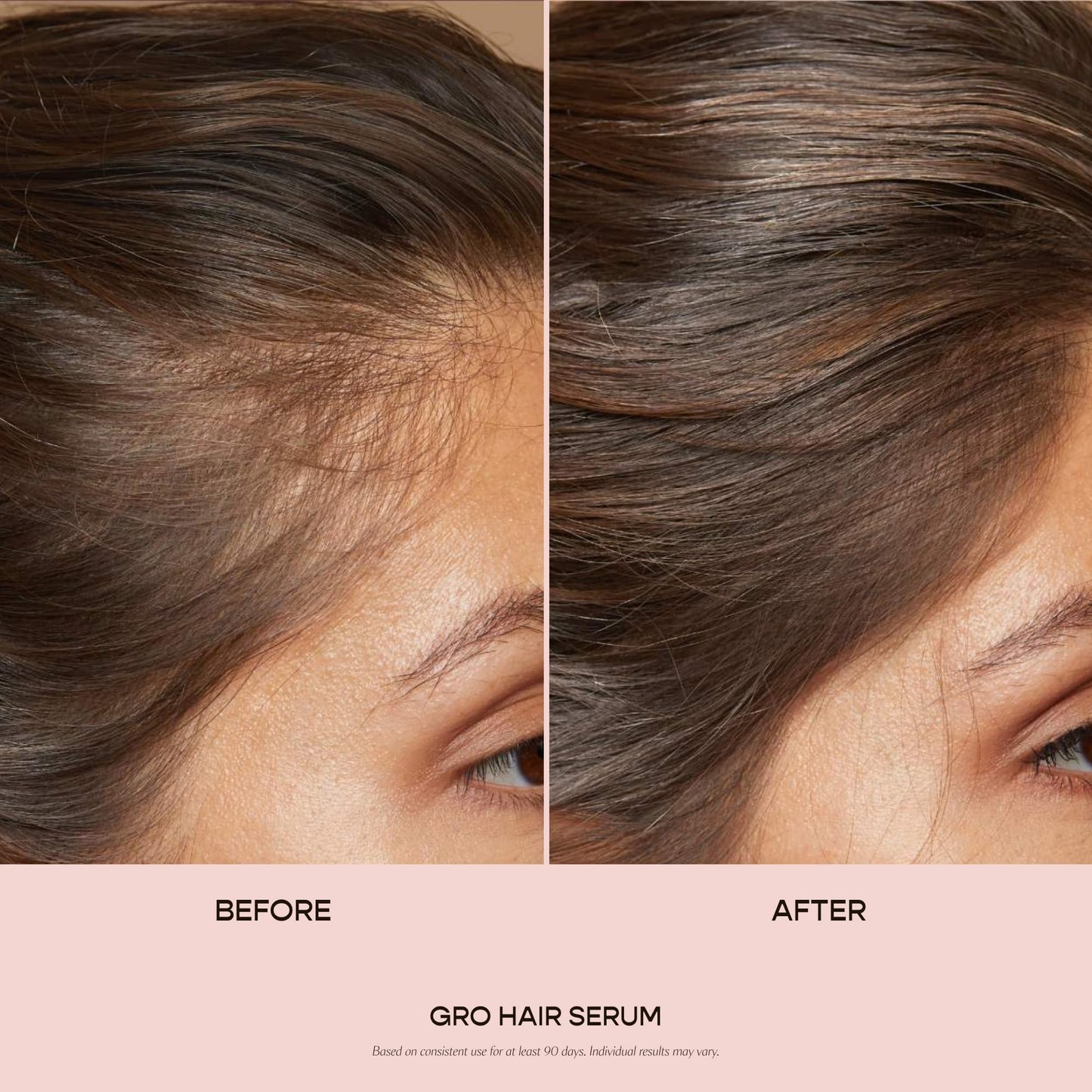 Misty Rose VEGAMOUR GRO Hair Serum for Thinning Hair, Thicker Fuller Looking Hair, Non Oily Tonic for Healthier Scalp, 30 Day Supply 1.0 fl oz, 1 Pack