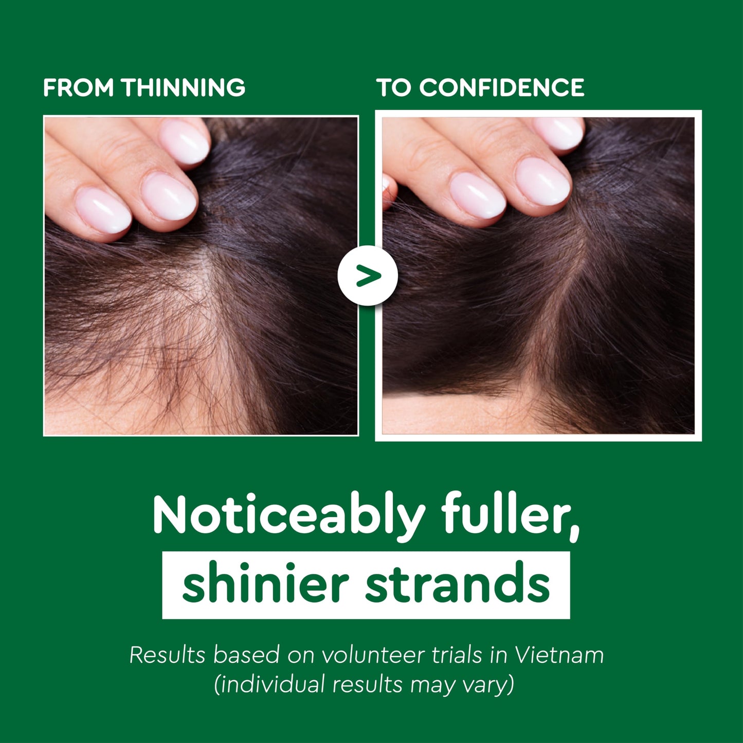 Forest Green VIETNAM Hair Growth Shampoo for Thinning Hair with Polygonum Multiflorum, 2 in 1 Shampoo & Conditioner, Strengthens Weak Roots, Fuller Thicker Look, Mothers Day Gifts for Mom (14.8 oz)