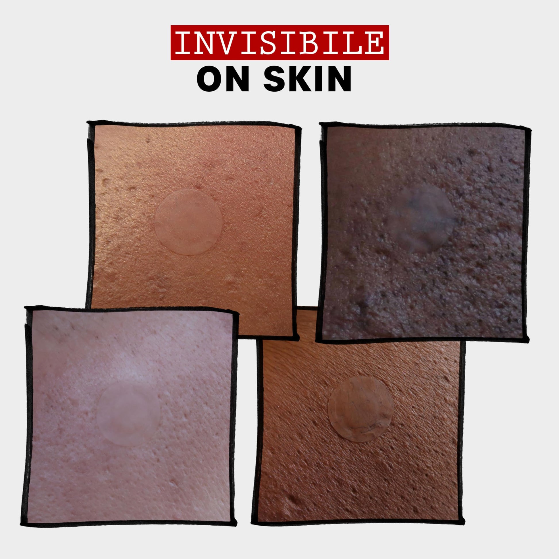 Lavender THAYERS Invisible S.O.S Hydrocolloid Acne Pimple Patch, Ultra-Thin Design Instantly Reduces Look of Blemishes, Set of 22 Pimple Patches
