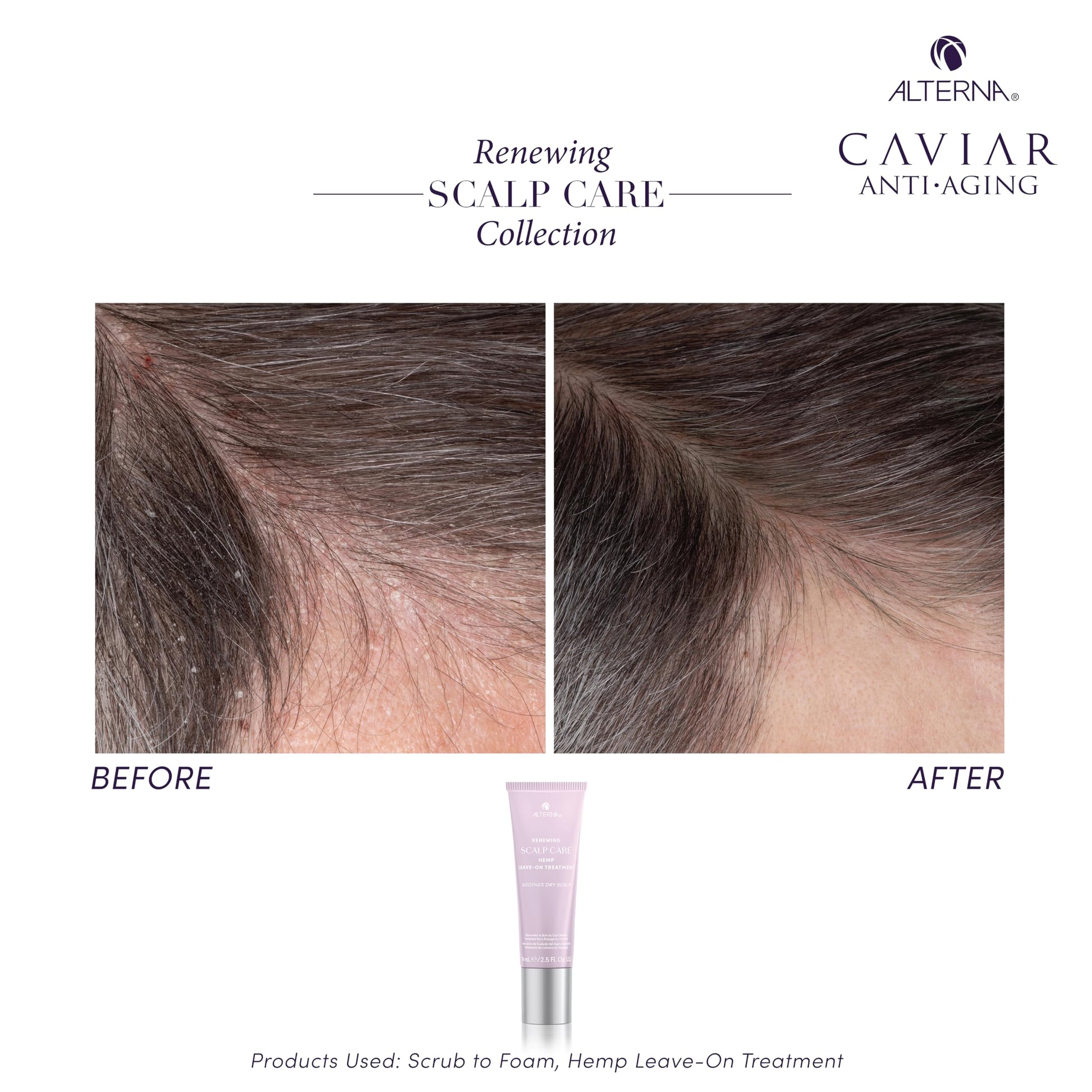 White Smoke Alterna Haircare Renewing Scalp Care Hemp Leave On Vegan Hair and Scalp Treatment, 2.5 Fl Oz Lightweight and Fast Absorbing to Moisturize, Soothe and Calm Scalp