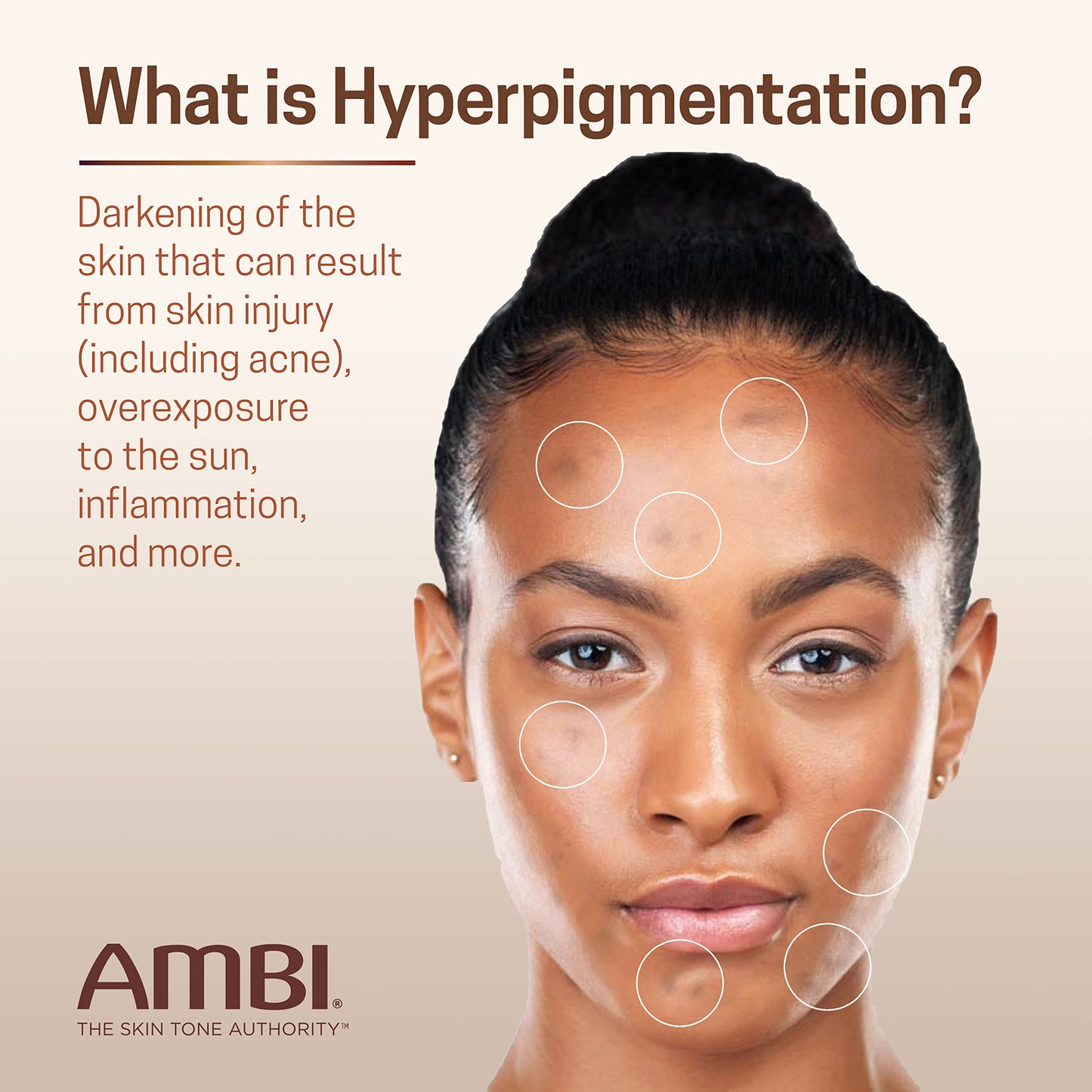 Gray Ambi Even & Clear Advanced Fade Cream, Hydroquinone-free, Hyperpigmentation Treatment, Stubborn Dark Spot Corrector, Results In As Little As 2-3 Weeks, Niacinamide, Licorice Root Extract, PHA, 1 Fl Oz