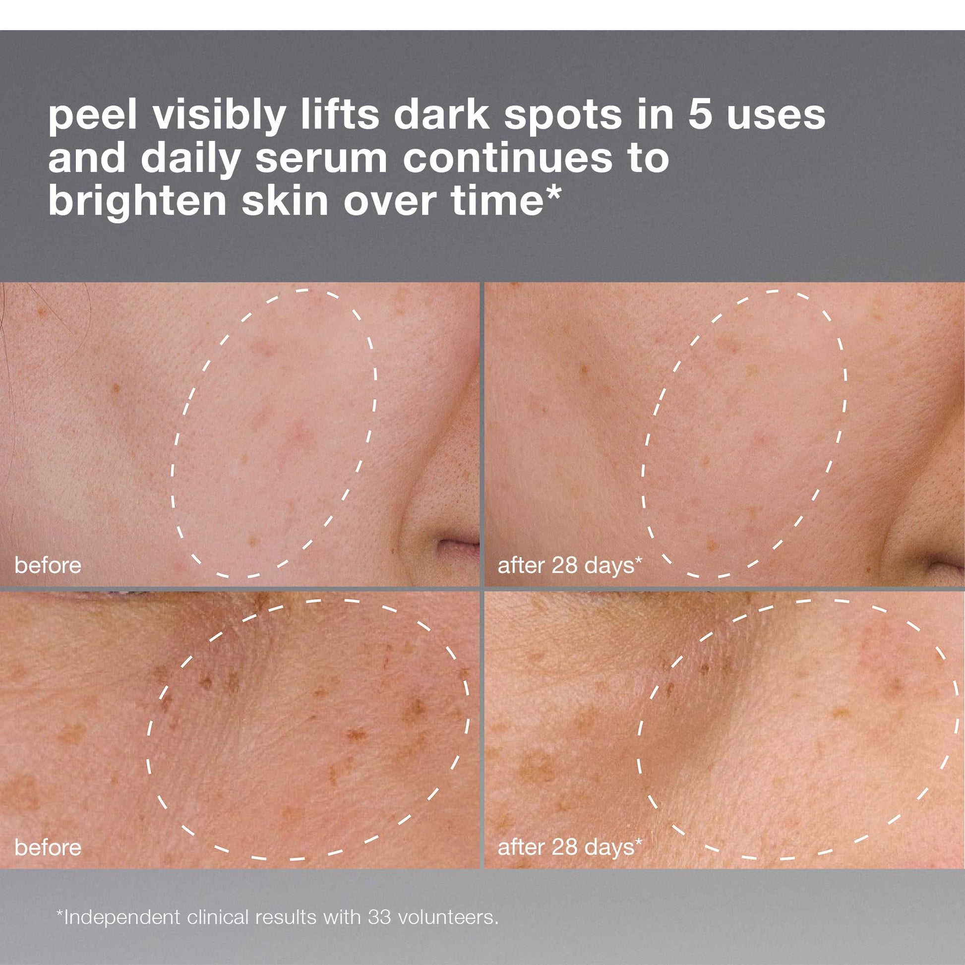 Rosy Brown Dermalogica PowerBright Dark Spot System Skin Care Kit, Includes Face Serum and Peel - Fade, Lift, and Prevent Dark Spots and Hyperpigmentation