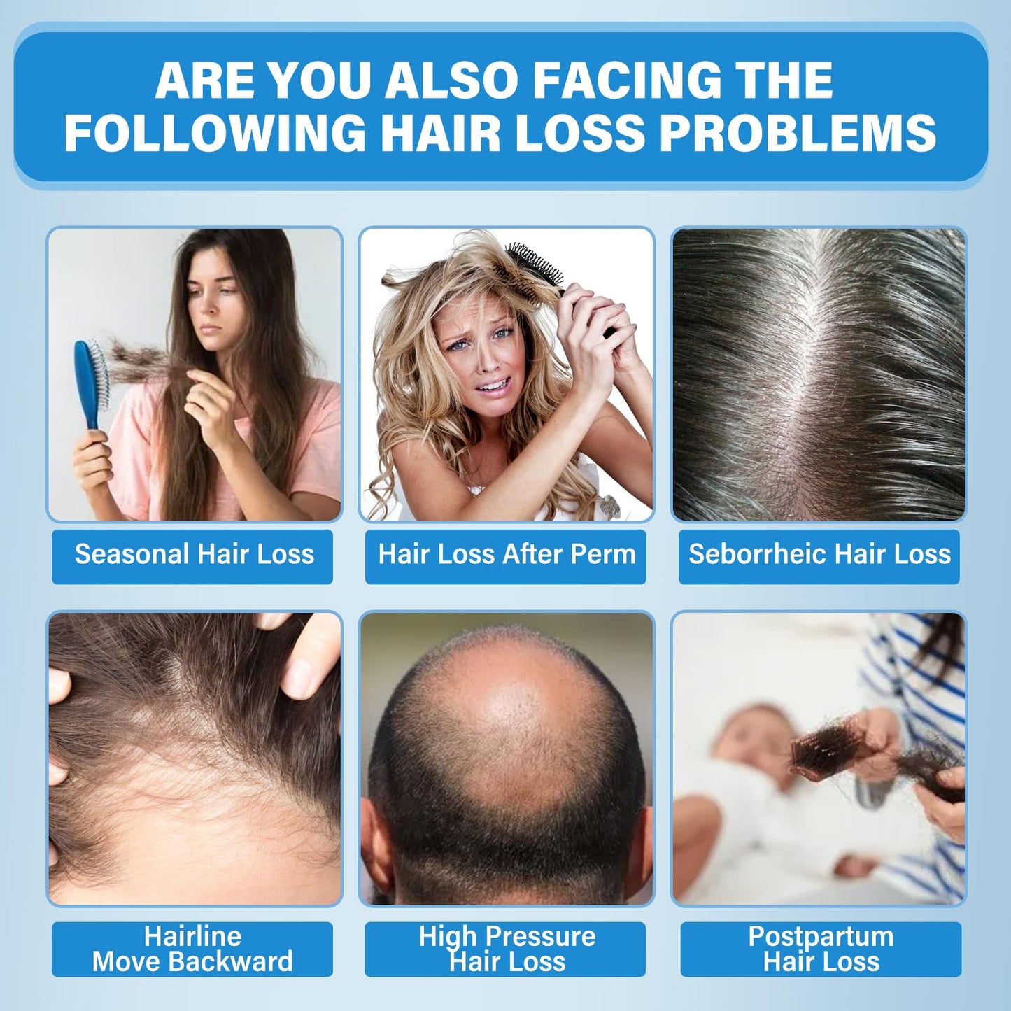 Light Gray Minoxidil for Men and Women, 5% Hair Growth Serum for Thinning Scalp, Non-Greasy Topical Spray for Thicker, Fuller-Looking Hair