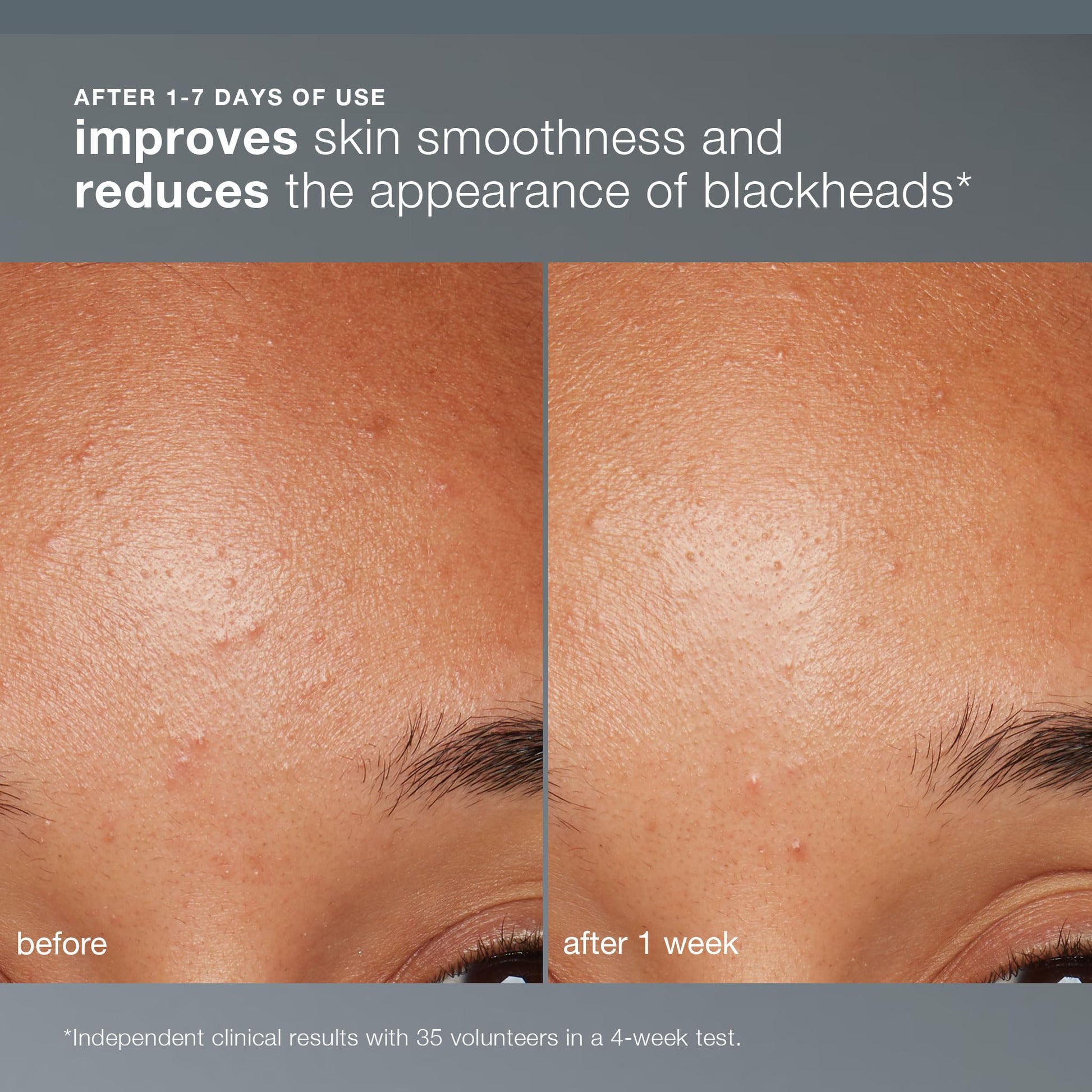 Dark Salmon Dermalogica Daily Microfoliant, Face Exfoliator Scrub Powder with Salicylic Acid and Papaya Enzyme, Achieve Brighter, Smoother Skin Daily