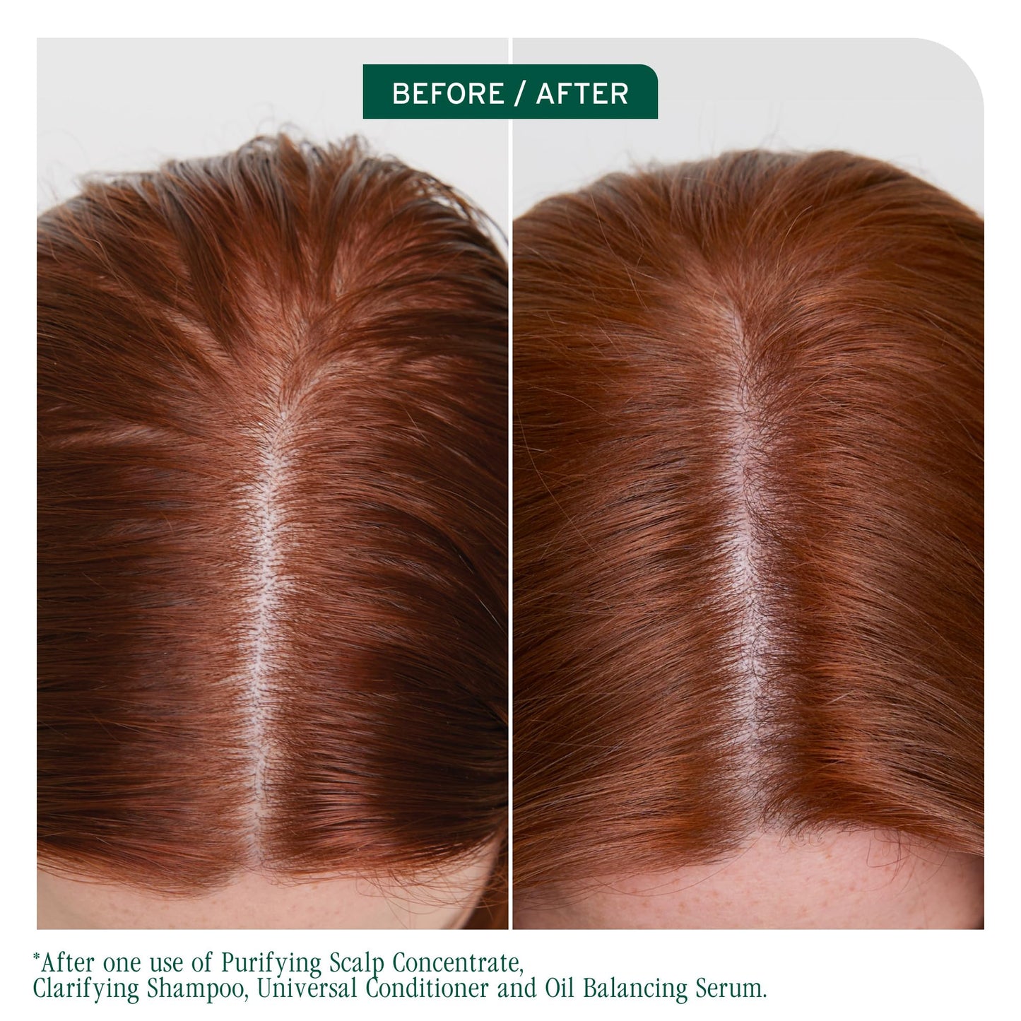 Saddle Brown Biolage Scalp Sync Clarifying Shampoo - Residue & Buildup Remover, For Oily Scalp, Fermented Tea & Glycolic Acid, Vegan & Paraben-Free