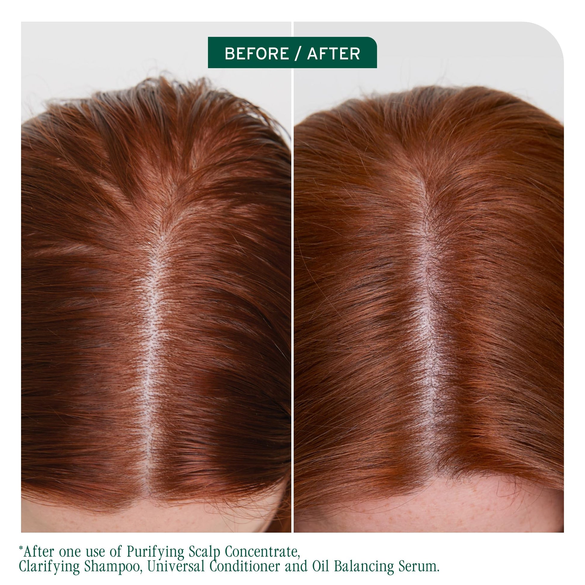 Saddle Brown Biolage Scalp Sync Clarifying Shampoo - Residue & Buildup Remover, For Oily Scalp, Fermented Tea & Glycolic Acid, Vegan & Paraben-Free