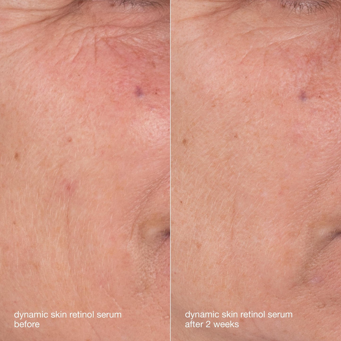Dark Salmon Dermalogica Skin Aging Solutions Kit, Anti Aging Skincare Set - Includes: Face Cleanser, Serum, Moisturizer with SPF, and Cream, Travel Size