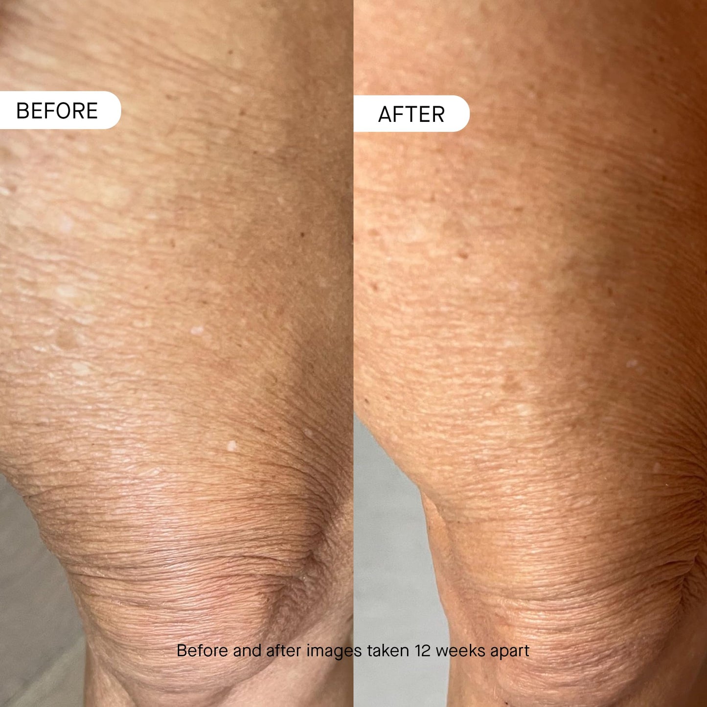 Tan oneskin BODY OS-01 Peptide Topical Supplement & Skin Longevity Age Reversal Moisturizer | Safe for Sensitive Skin, Fragrance-Free, 250 mL / 8.45 oz