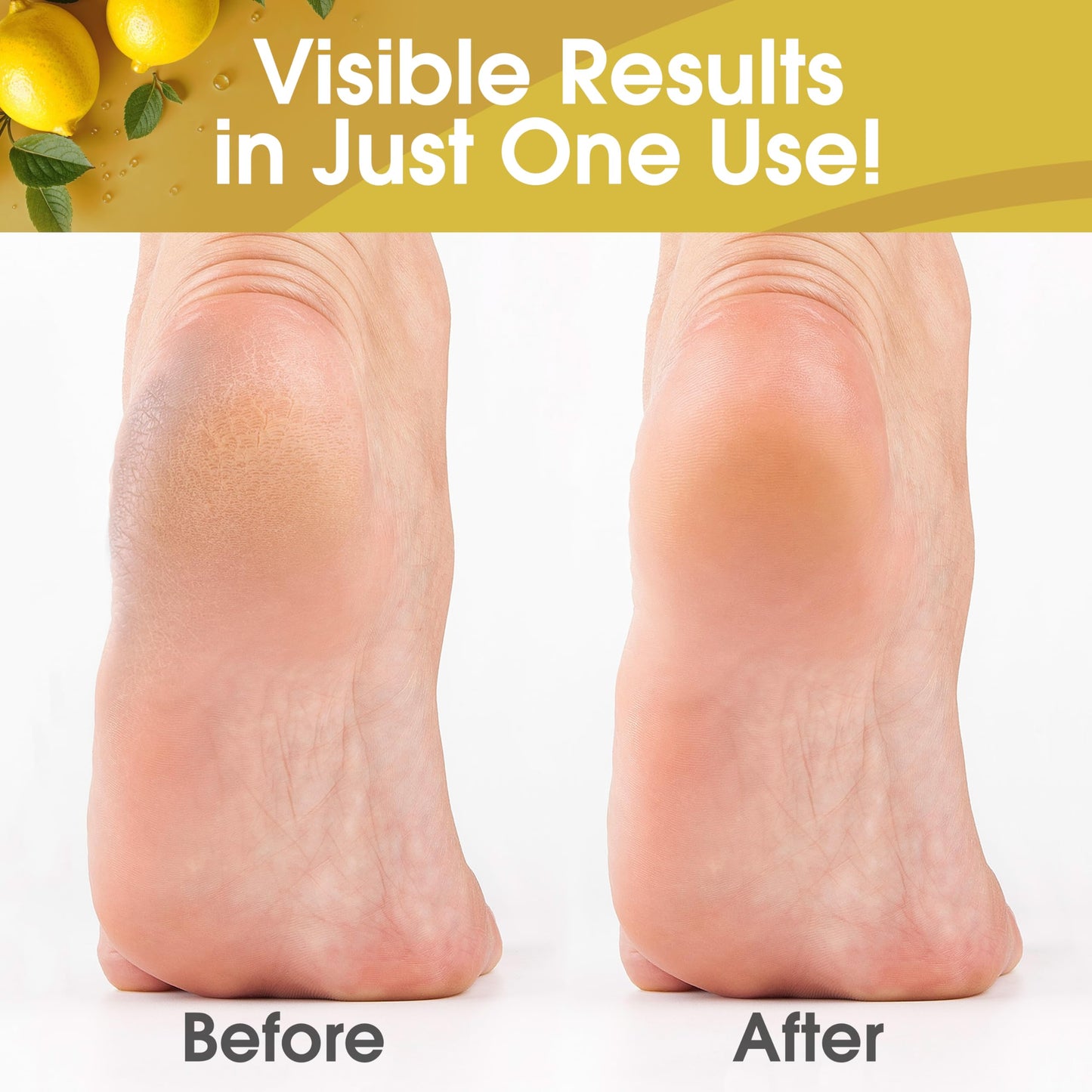 White Smoke DeEnti Callus Remover for Feet, Extra Strength Foot Callus Remover Gel, 8oz Salon Grade Home Pedicure Supplies for Dry Skin, Cracked Heel, Professional Strength Foot Care, Lemon