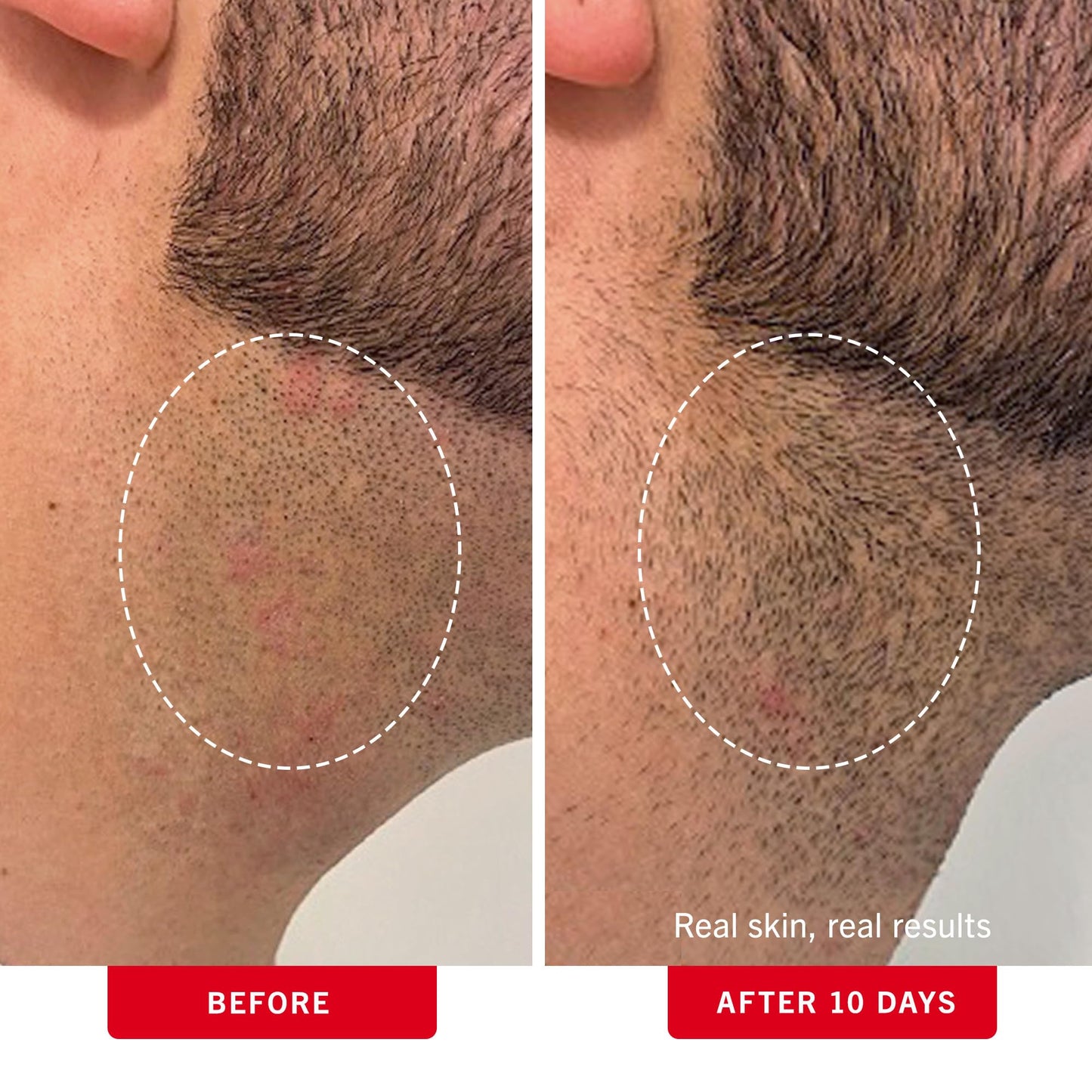 Dim Gray First Aid Beauty - Ingrown Hair Pads with BHA + AHA - Aftershave Treatment Pads to Help Prevent Razor Bumps for Men & Women - Exfoliate Underarms & Bikini Area - Compostable for Daily Use - 28 Pads