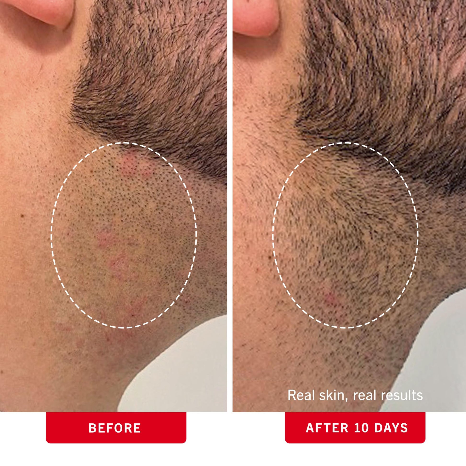 Dim Gray First Aid Beauty - Ingrown Hair Pads with BHA + AHA - Aftershave Treatment Pads to Help Prevent Razor Bumps for Men & Women - Exfoliate Underarms & Bikini Area - Compostable for Daily Use - 28 Pads