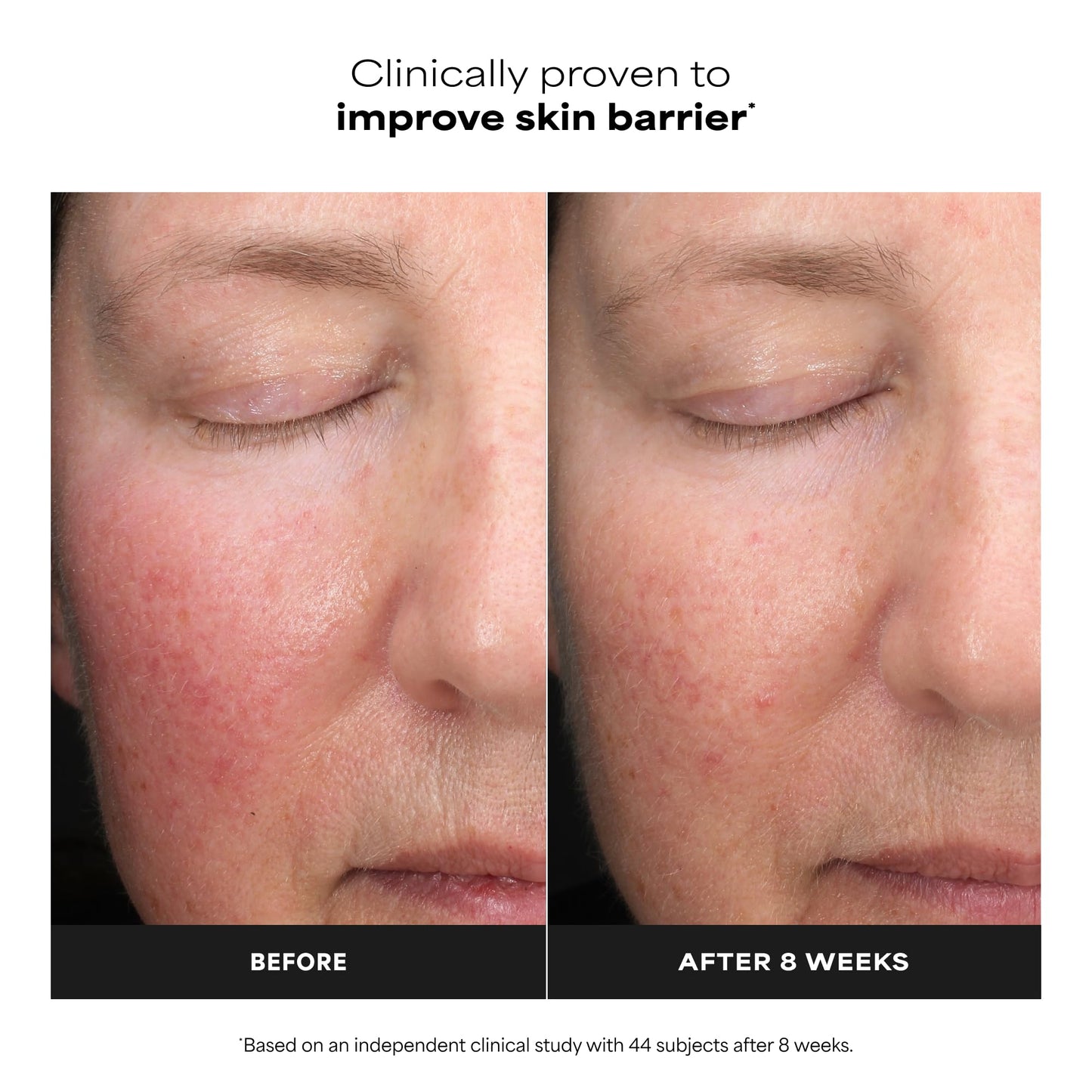 White Smoke Paula’s Choice Liquid Face Exfoliant 6% Mandelic Acid + 2% Lactic Acid Exfoliant, Gentle Daily AHA Exfoliation for Discoloration, Bumpy Texture & Radiance, for Sensitive Skin, Fragrance-Free, 1 fl oz