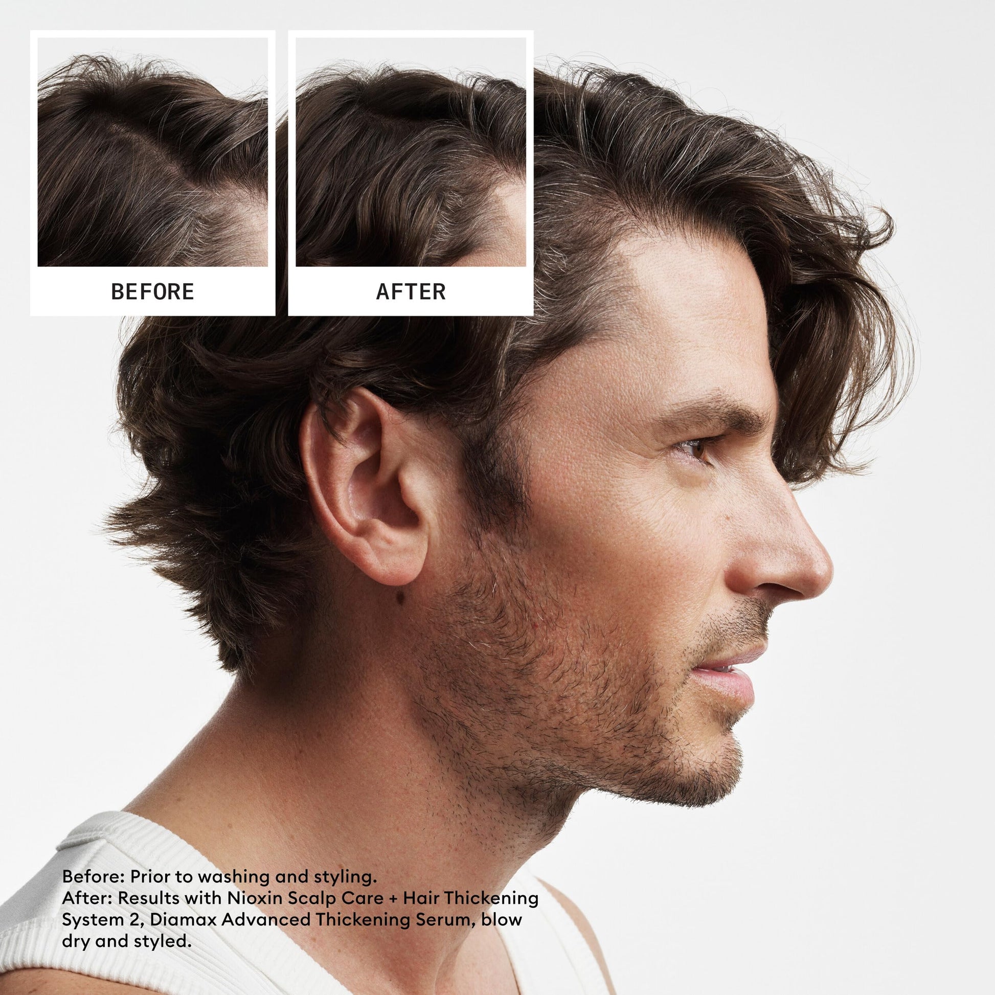 White Smoke Nioxin Scalp + Hair Thickening System 2 | For Natural or Untreated Hair with Progressed Thinning| Full Size| 3 Month Supply