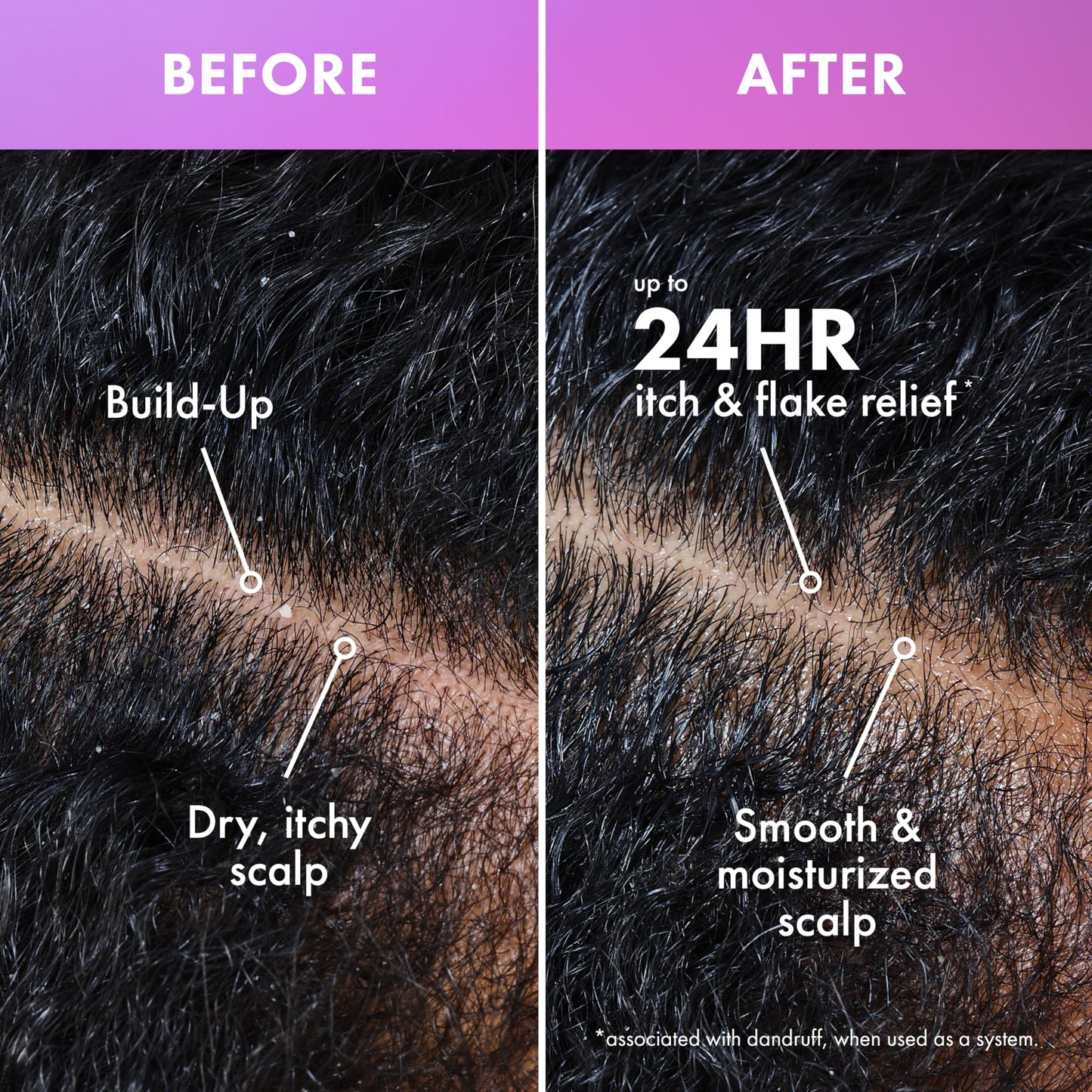 Black Mielle Organics Lavender & Lychee Scalp Moisturizing Lotion, Leave-In Treatment for Dry Itchy Scalp, Lightweight Scalp Moisturizer with Niacinamide Aloe Menthol, Protective Styles, 4 fl oz