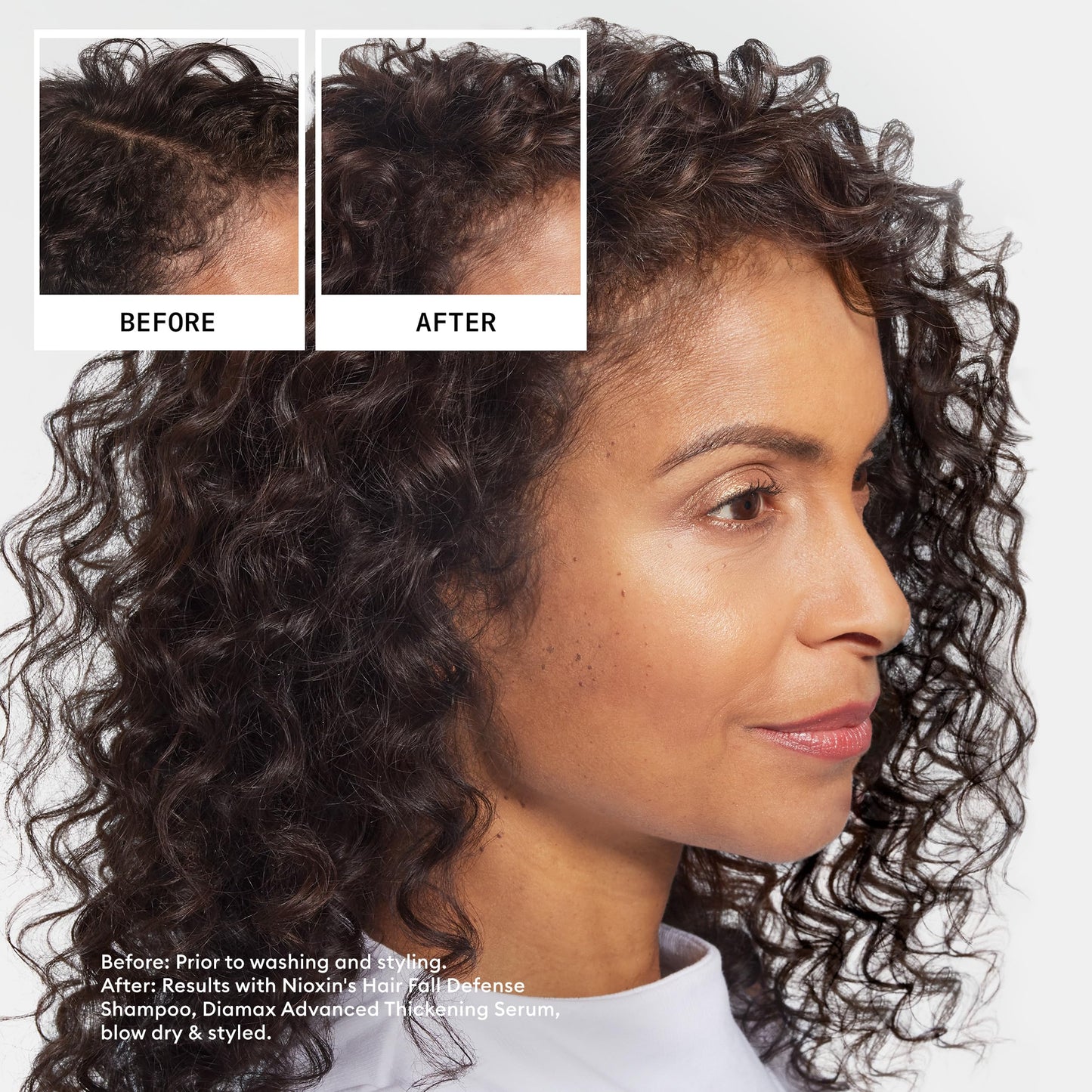 Black NIOXIN Hair Fall Defense Shampoo | Activates Hair Follicles for Visibly Less Hair Loss | With Niacinamide, Caffeine, Lauric Acid, and Sandalore | 8.1 Fl Oz.