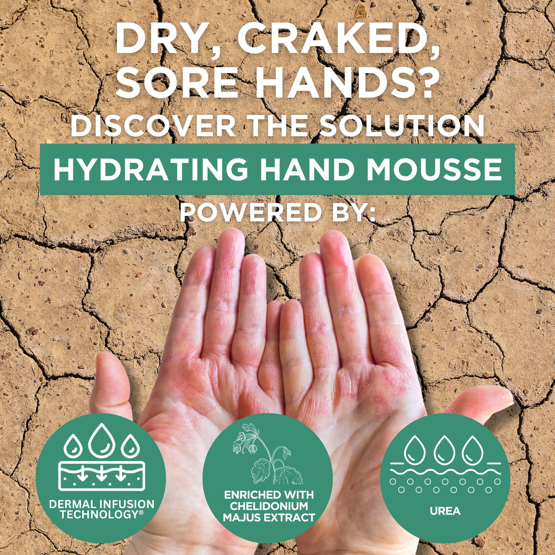 Tan Footlogix Hydrating Hand Mousse with Dermal Infusion Technology® | Deep Hydration for Dry Hands | Urea-Enriched Formula | Fast-Absorbing | 4.23 ozl/119.9 g/125 ml